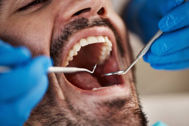 Emergency Dental Services in Huntsville, TX